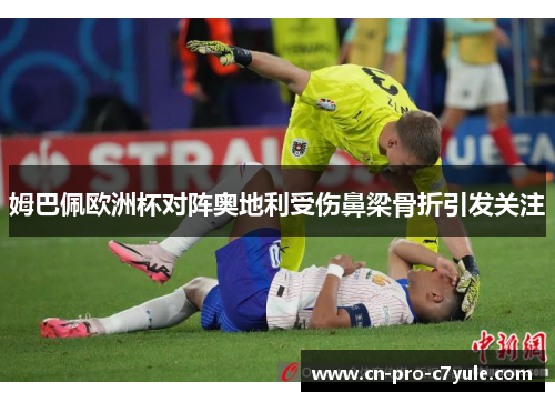 姆巴佩欧洲杯对阵奥地利受伤鼻梁骨折引发关注 姆巴佩欧洲杯对阵奥地利受伤鼻梁骨折引发关注